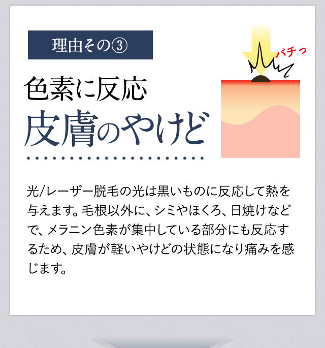 脱毛が痛い理由③皮膚のやけど