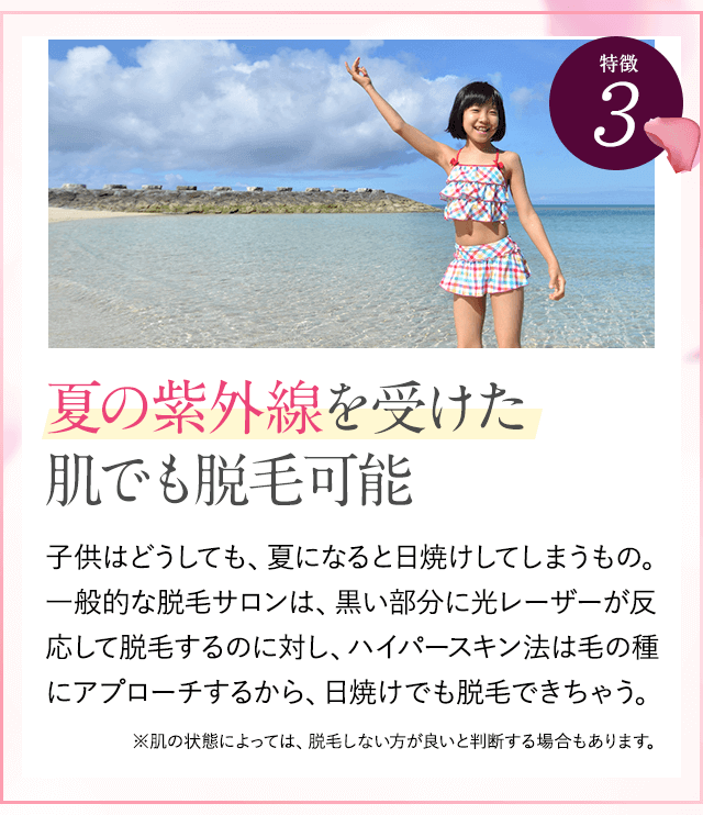 夏の紫外線を受けた肌でも脱毛可能